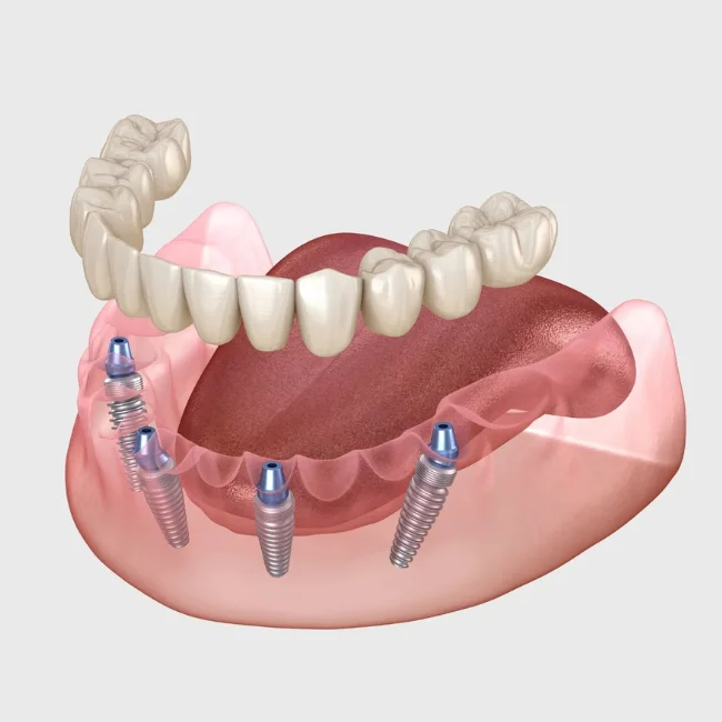 Featured image for Auto-prepared featured image